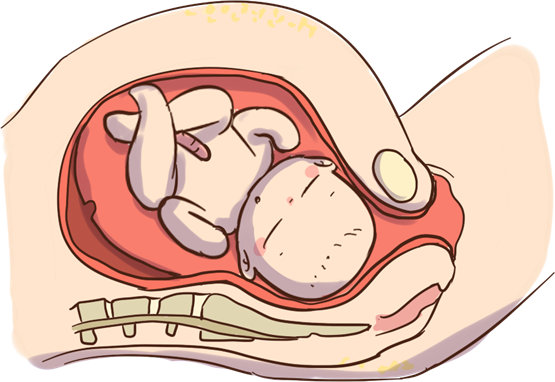 芒果体育观察 | 子宫脱垂是什么 麦特斯磁刺激仪助力女性盆底康复